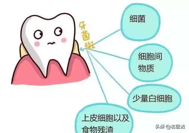 牙周炎才是牙齿松动的罪魁祸首,牙周炎导致全部牙齿脱落镶什么牙