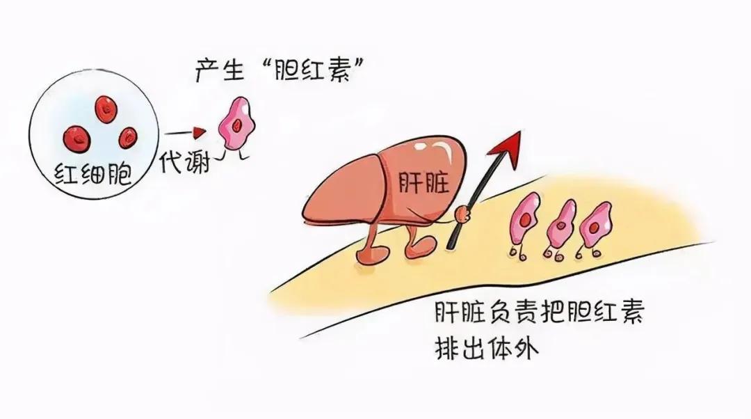 胆红素和间接胆红素偏高说明什么,胆红素升高主要原因咨询专家