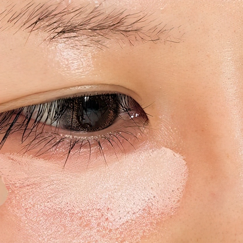 血管型黑眼圈怎么消除,戴眼镜黑眼圈怎么消除