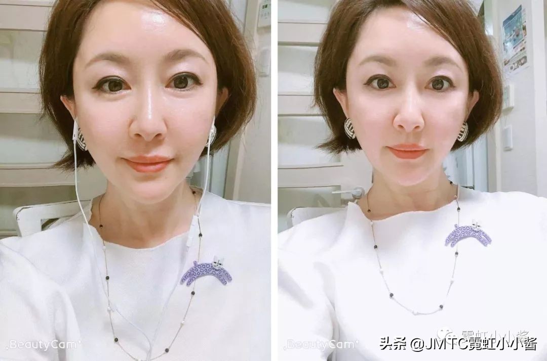 日本小姐姐针灸瘦脸视频,小姐姐打瘦脸针视频