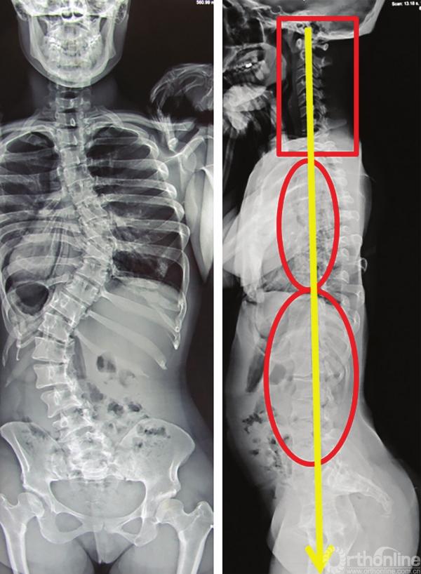 人体平衡分析,健身气功脊柱平衡整套教学视频