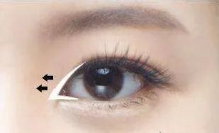 整形常见项目分布图,整形项目黄金搭配