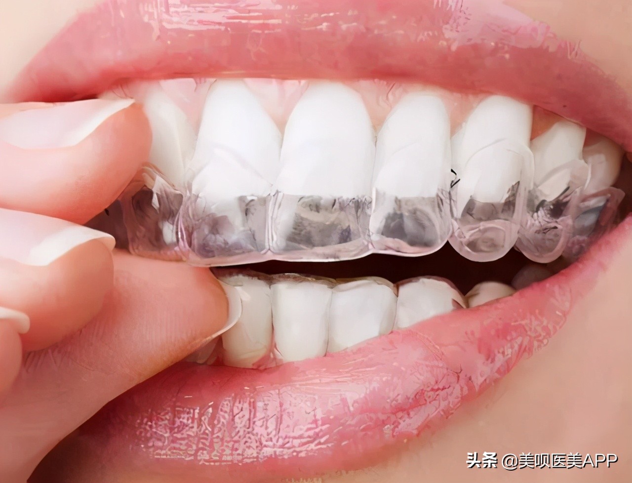 凸嘴女孩的发型侧面好看,水原希子是什么脸型