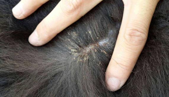 去头发虱子与虱子卵最有效方法,去除头上虱子和虱子卵最好小窍门