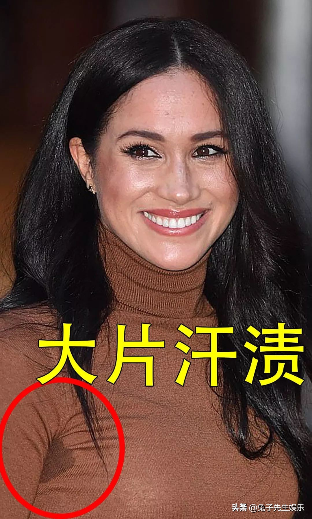 梅根为什么怕冷,梅根有什么症状