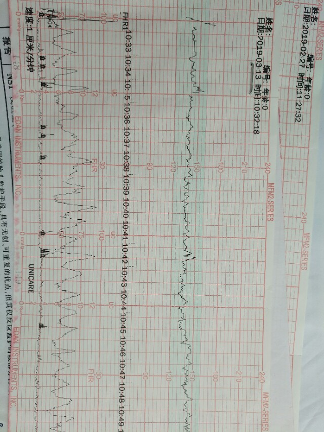孕期产检全流程一次性说清楚了,孕期检查全流程