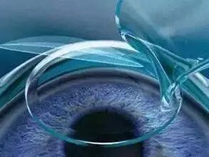 这几类情况医保不予报销您知道吗,武汉医保哪6种不予报销