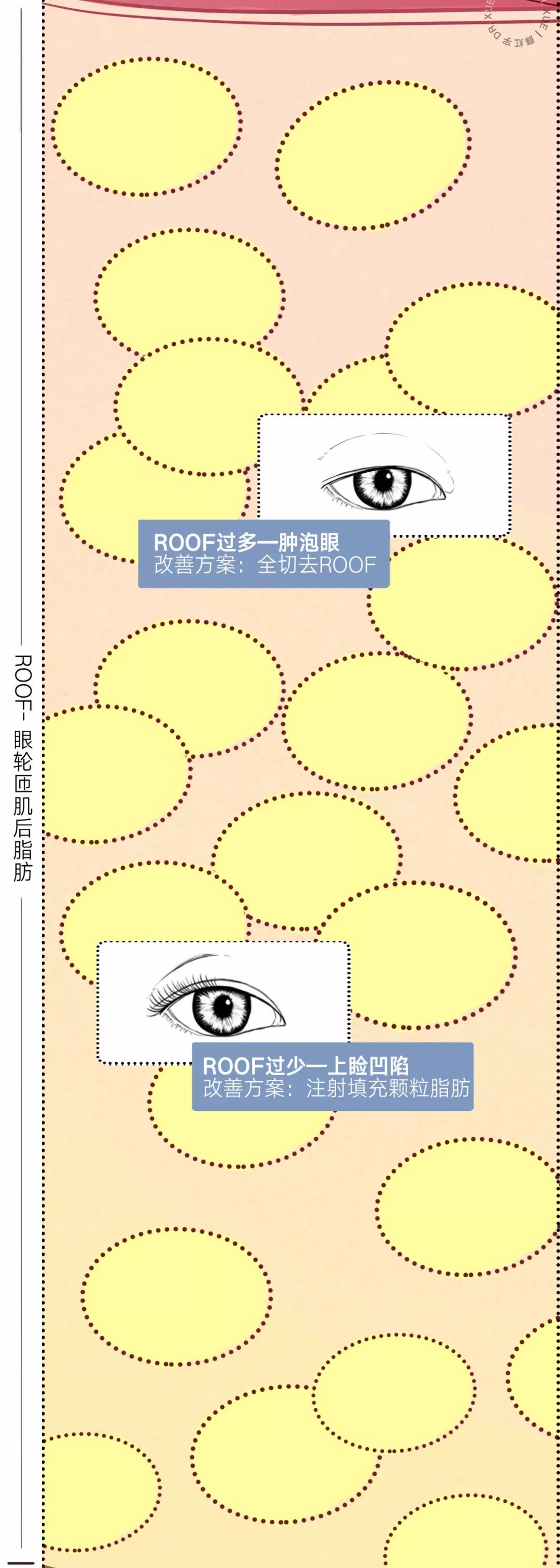 眼睛种类图解漫画,漫画眼睛的几种形态