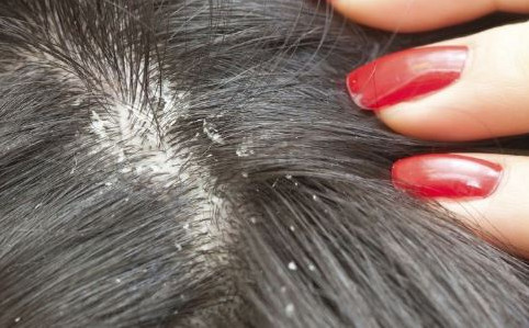 比较好用的德国防脱发,德国十大最好用的护肤品