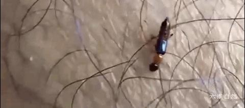 隐翅虫可以用手去拍打吗,拍打隐翅虫多久会有反应