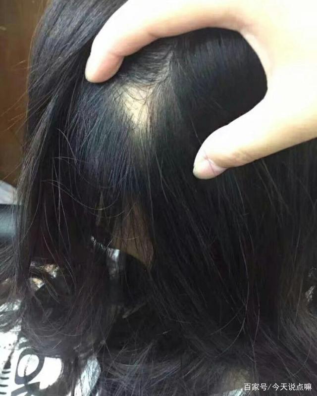 乡村灵异怪谈之治疗鬼剃头的林医生