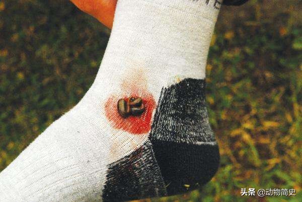 水蛭吸血疗法的正确方法,为什么水蛭吸血对身体有好处