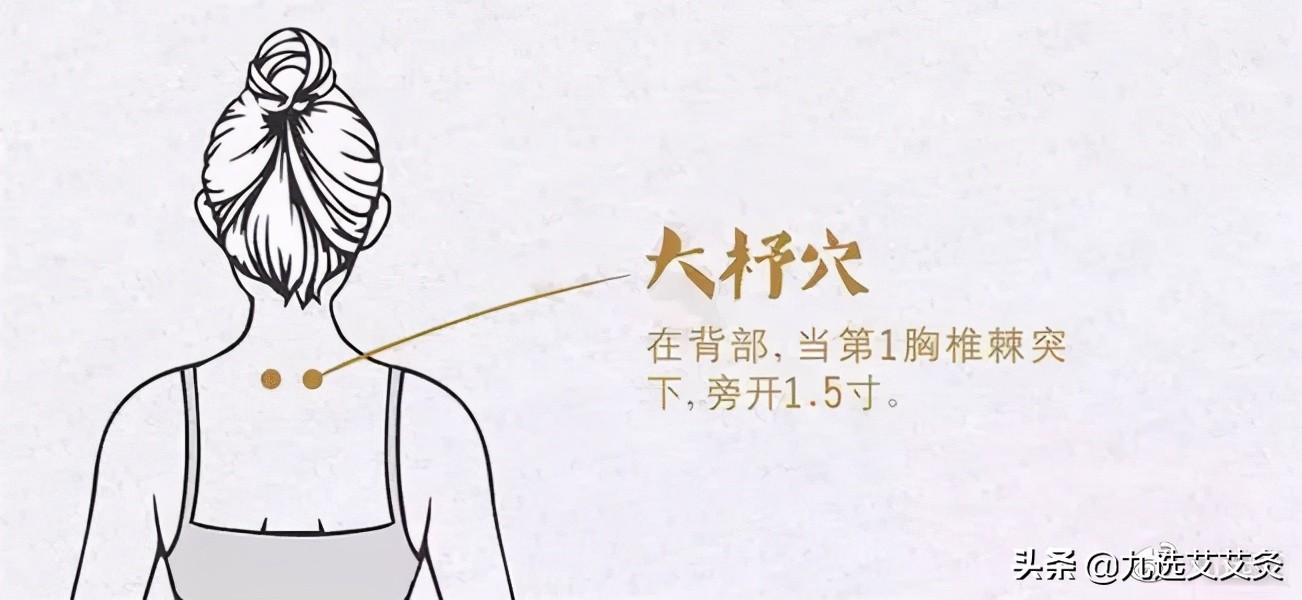 一觉醒来脖子疼肩膀疼用什么药,一觉醒来脖子痛怎么解决