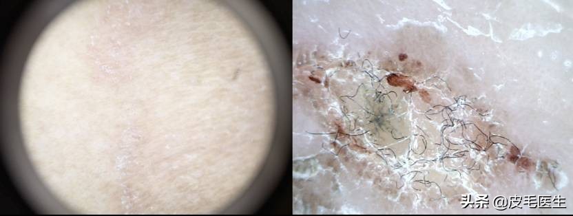 猫狗传染病如何预防治疗 (猫狗共同传染病有哪些)