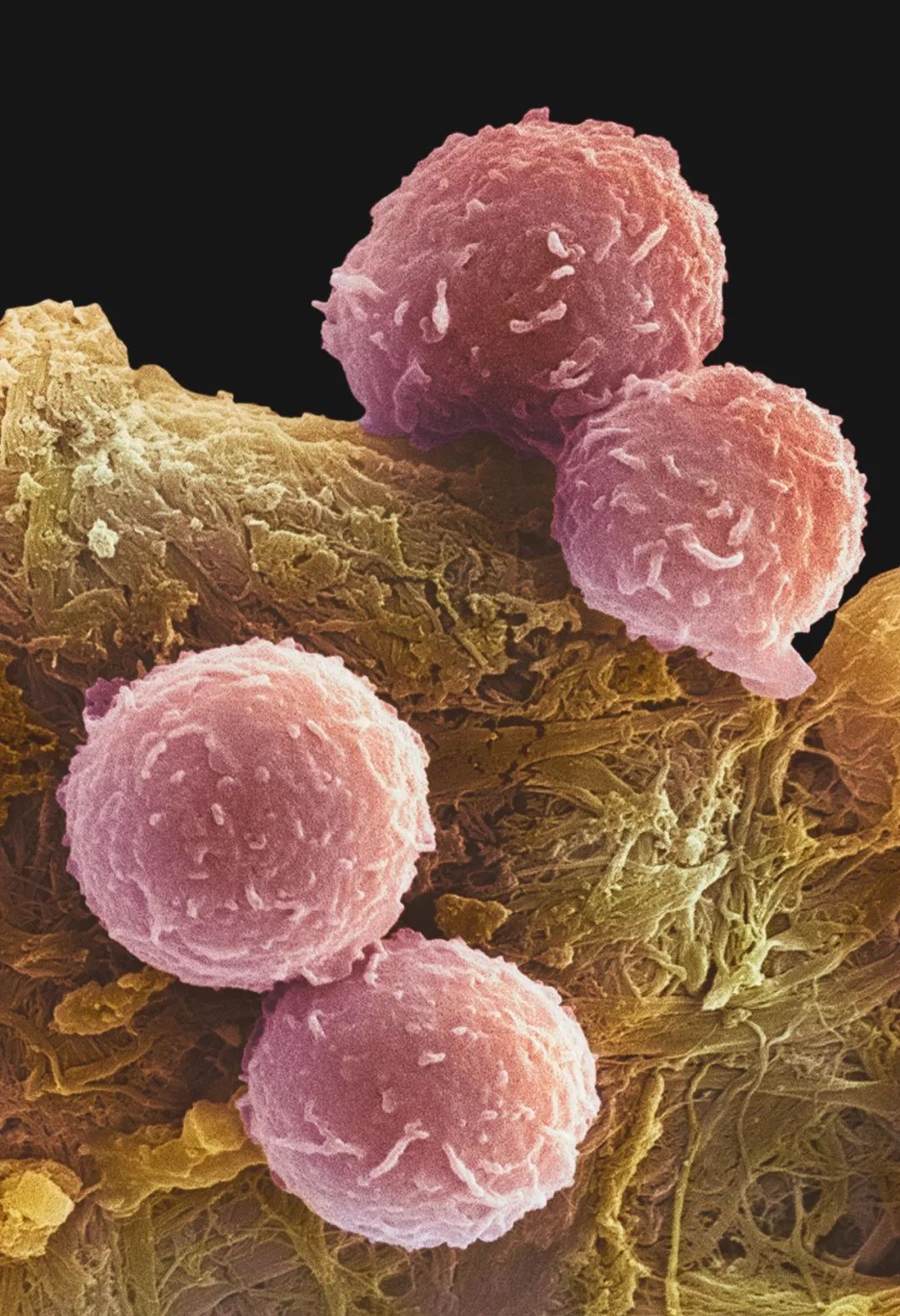 鍋囧鐥呮瘨鎰熸煋浜嗘垜,鍋囧鐥呮瘨鎰熸煋浜嗕綘