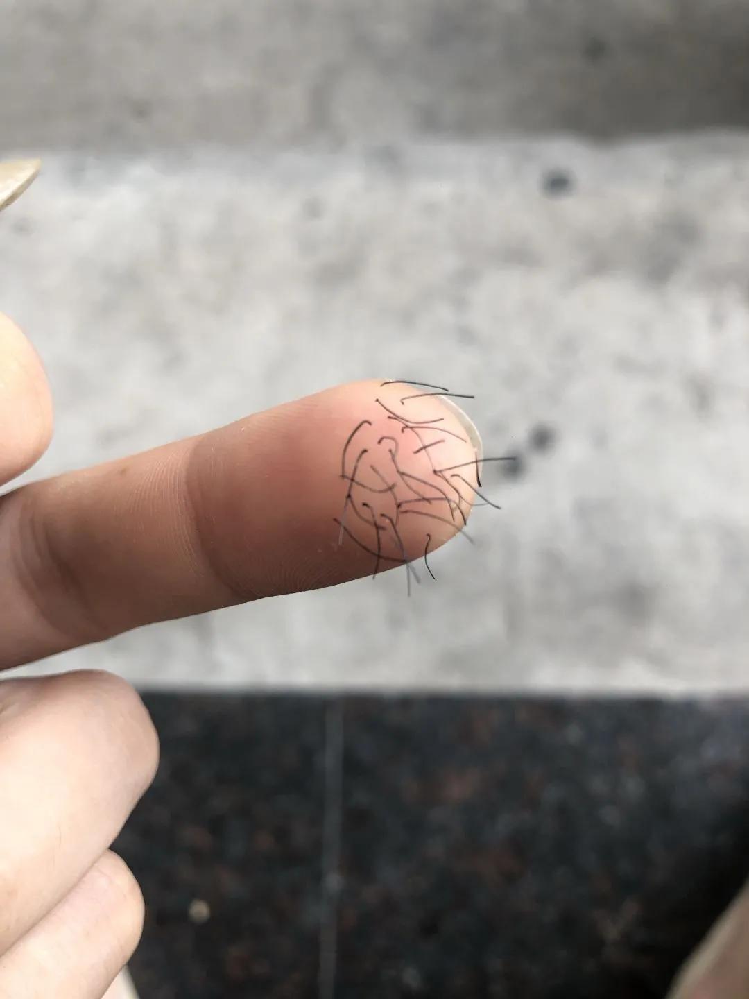 爬山回来手指头长毛什么梗,爬山回来手指头长了几根毛