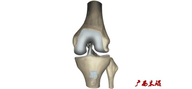 前交叉韧带扭伤最快自愈方法,前交叉韧带损伤膝关节会疼吗
