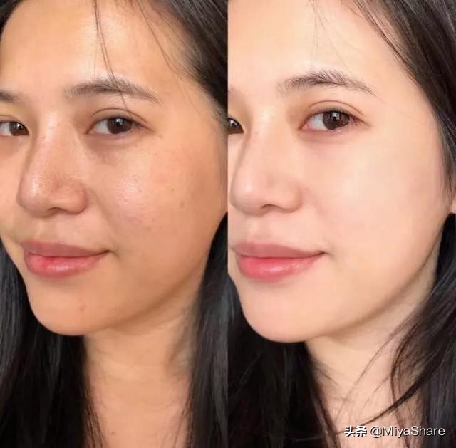 改善皮肤蜡黄暗沉的方法,皮肤暗沉发黄如何抗老