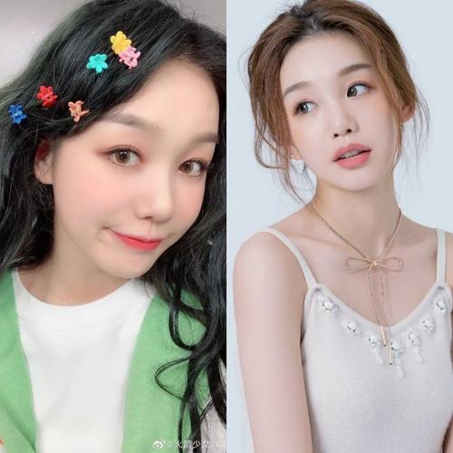 塌鼻梁鼻头大整容会有副作用吗,塌鼻梁凸嘴高颧骨整容