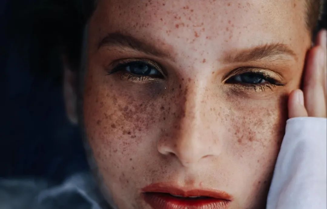 最常遇到的皮肤问题,最让人头疼的皮肤病