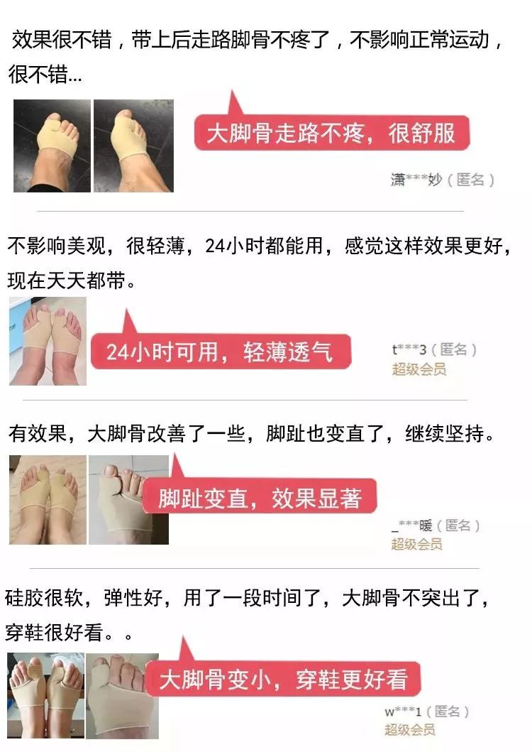 脚趾超级痛,轻度脚趾外翻如何矫正