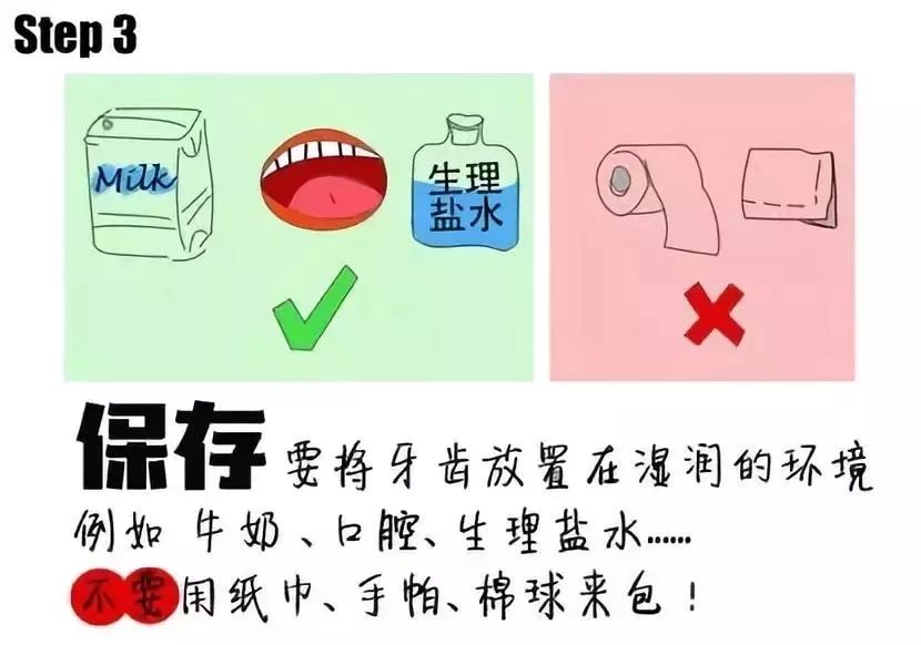 疫情期间口腔正畸处理,疫情期间正畸矫正处理