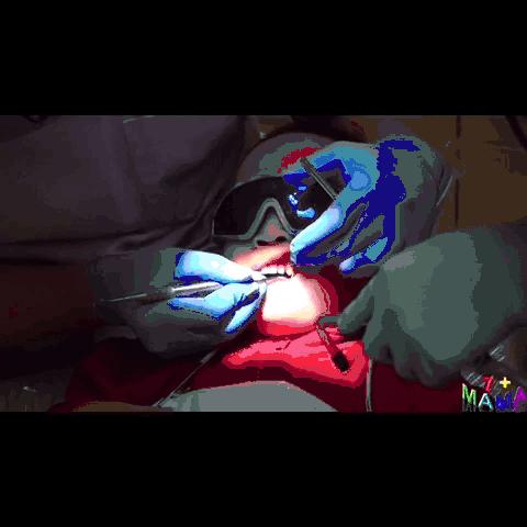 小朋友的牙菌斑要怎么去除,孩子有牙菌斑用什么刷牙