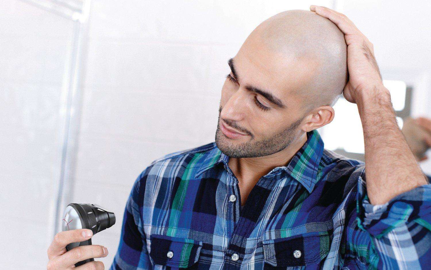 发际线高怎么办4种方法全搞定,40岁男人发际线太高适合什么发型