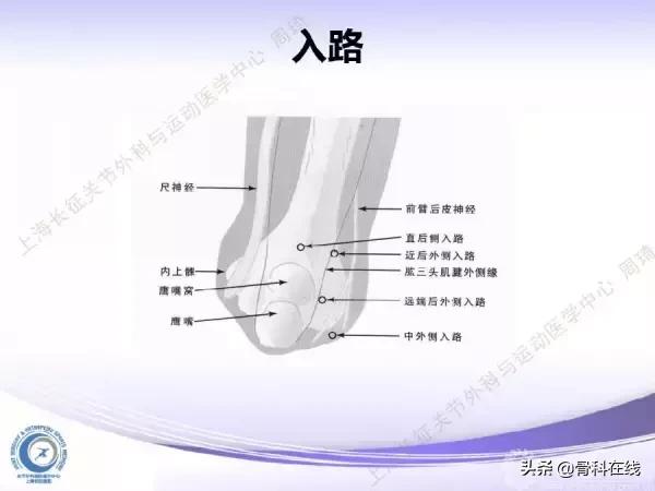 肘关节镜手术后引流,肘关节镜微创手术
