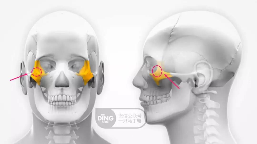颧弓高脸型怎么改善,有泪沟可以通过调整脸型改善嘛