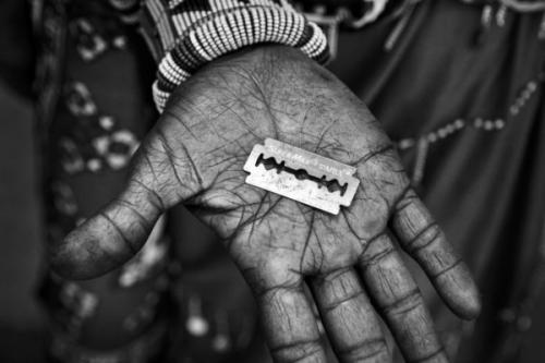 非洲最野蛮的陋俗，新娘为向丈夫表忠心，必须接受割礼