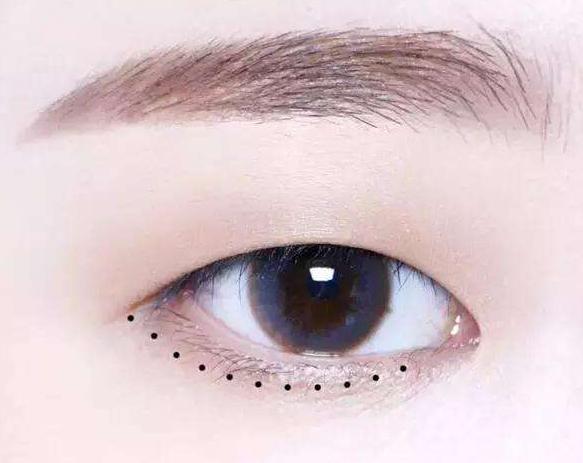 南华博士双眼皮,南华博士怎么样