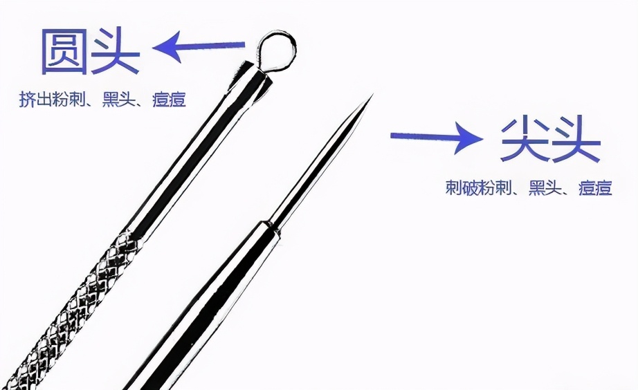 痘痘可以挤吗正确处理方法告诉你,教你正确的挤青春痘的方法