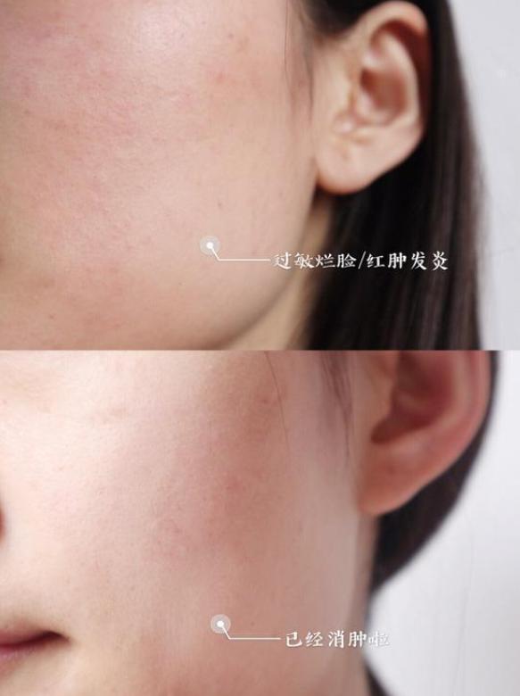 这面霜好用不踩雷,用过的都说好,让你做完美无瑕的瓷肌美人