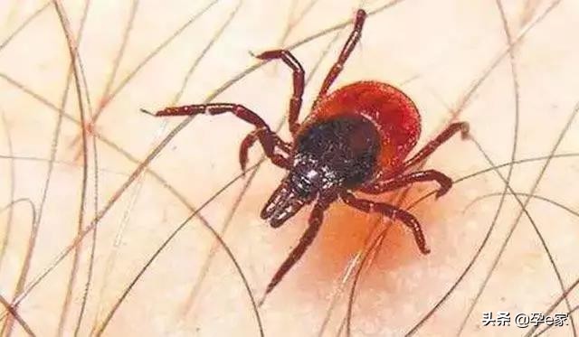 身上出现许多小黑痣,身上出现凸起黑痣一定要重视