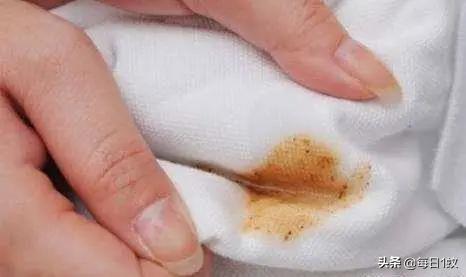 衣服上有污渍怎么清理掉,衣服粘上的污渍怎样去除