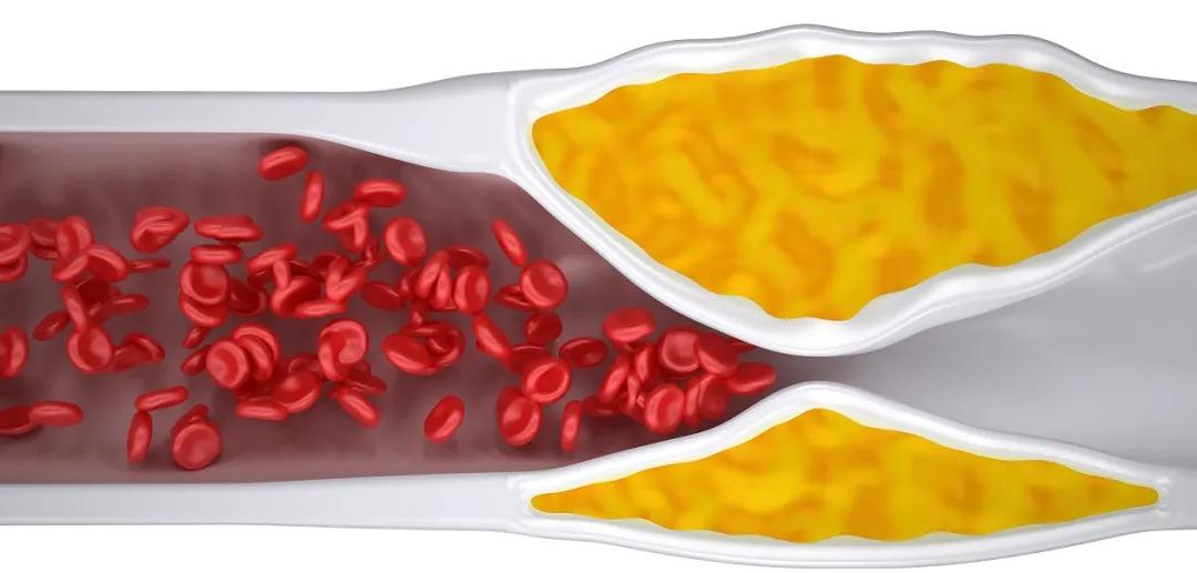 降胆固醇和降血脂最快的十种食物,降血脂最快的十大食物胡萝卜