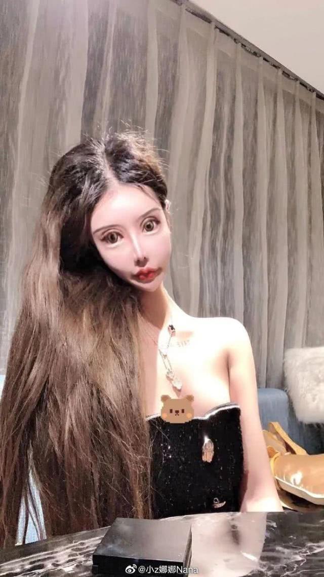 做6次双眼皮4次鼻子，下巴似铁锥眼睛整成球，16岁就整成这样好吗