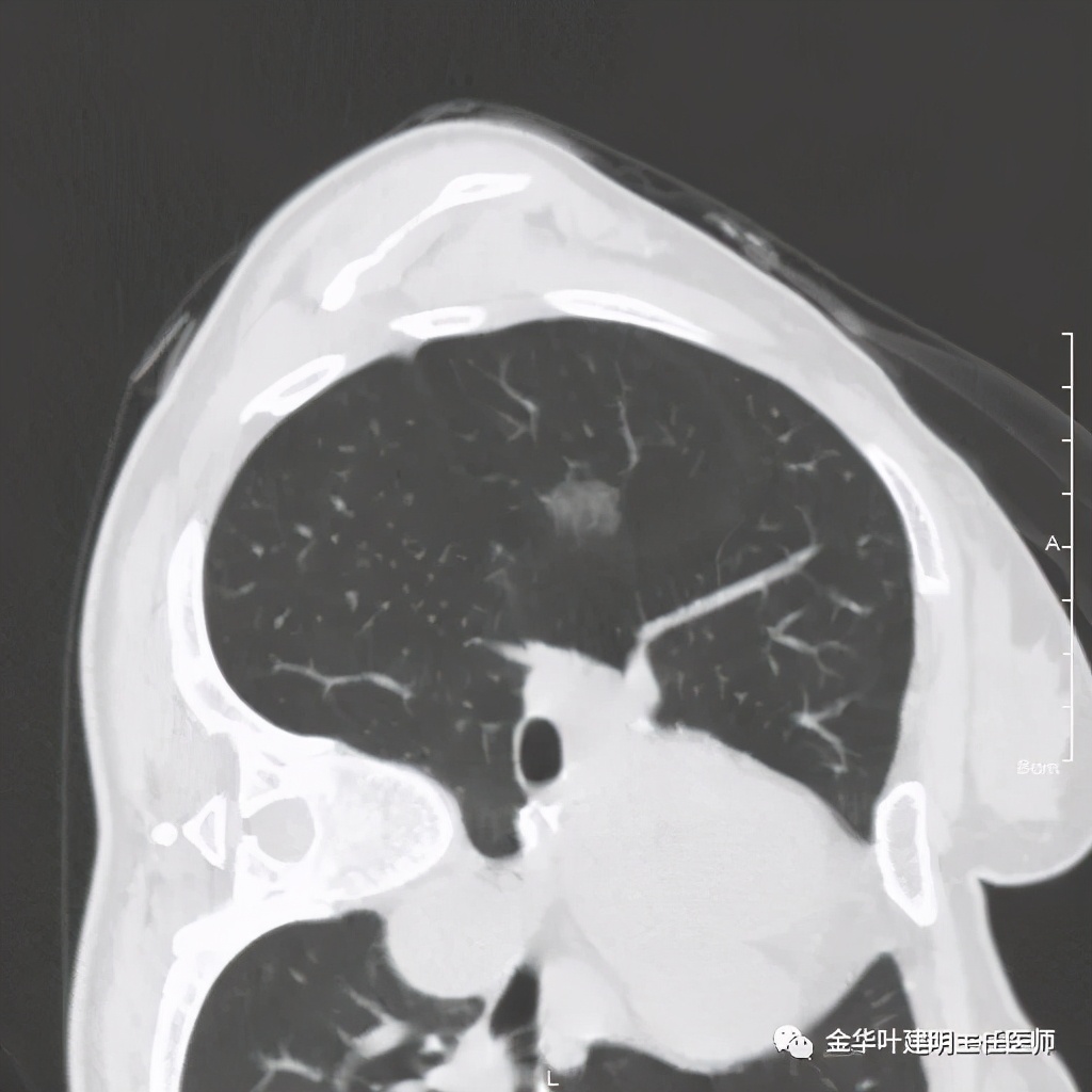 放个大招完整版教学,放个大招完整版前奏