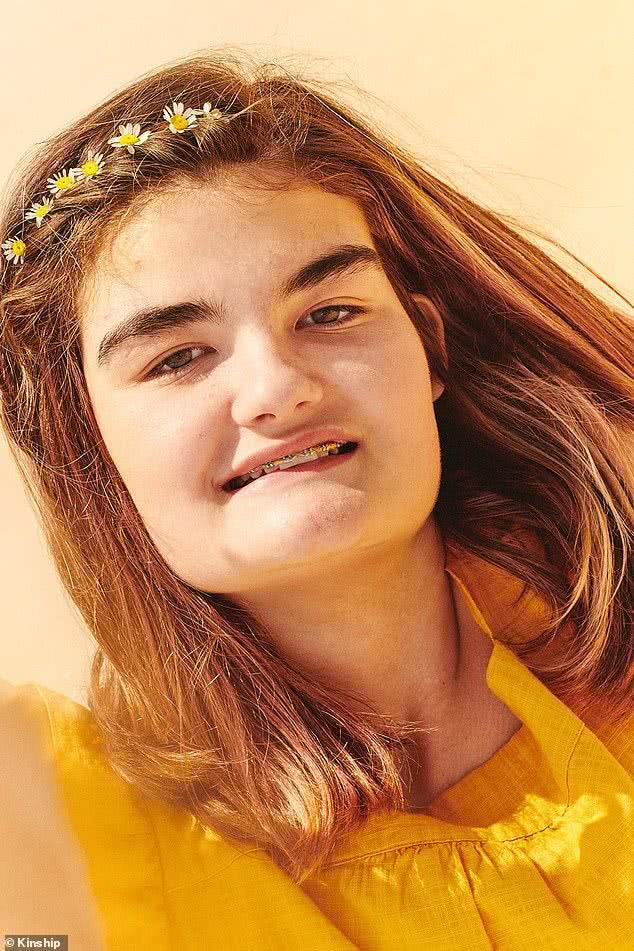 美国15岁残障女孩成为化妆品模特，梦想成真，妈妈担心网络*力暴**