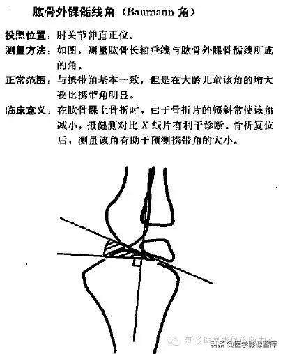 肘关节x线测量,肘关节骨骺示意图