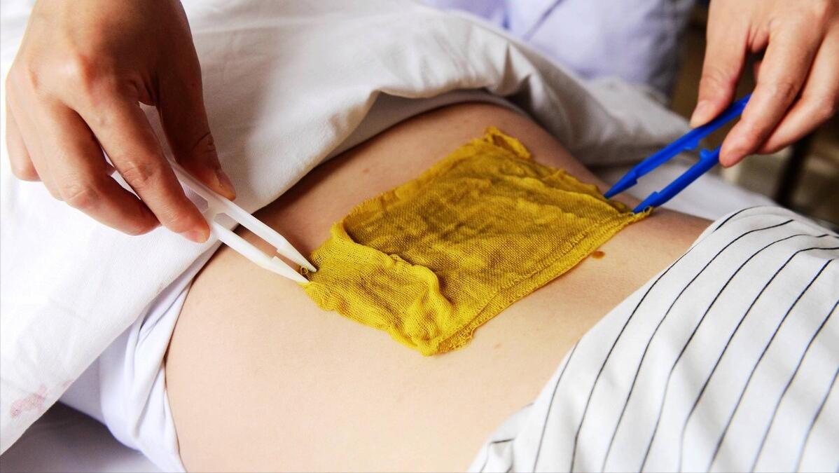 寒湿太重全身关节疼痛，不要盲目艾灸，推荐一张祛风散寒湿的好方