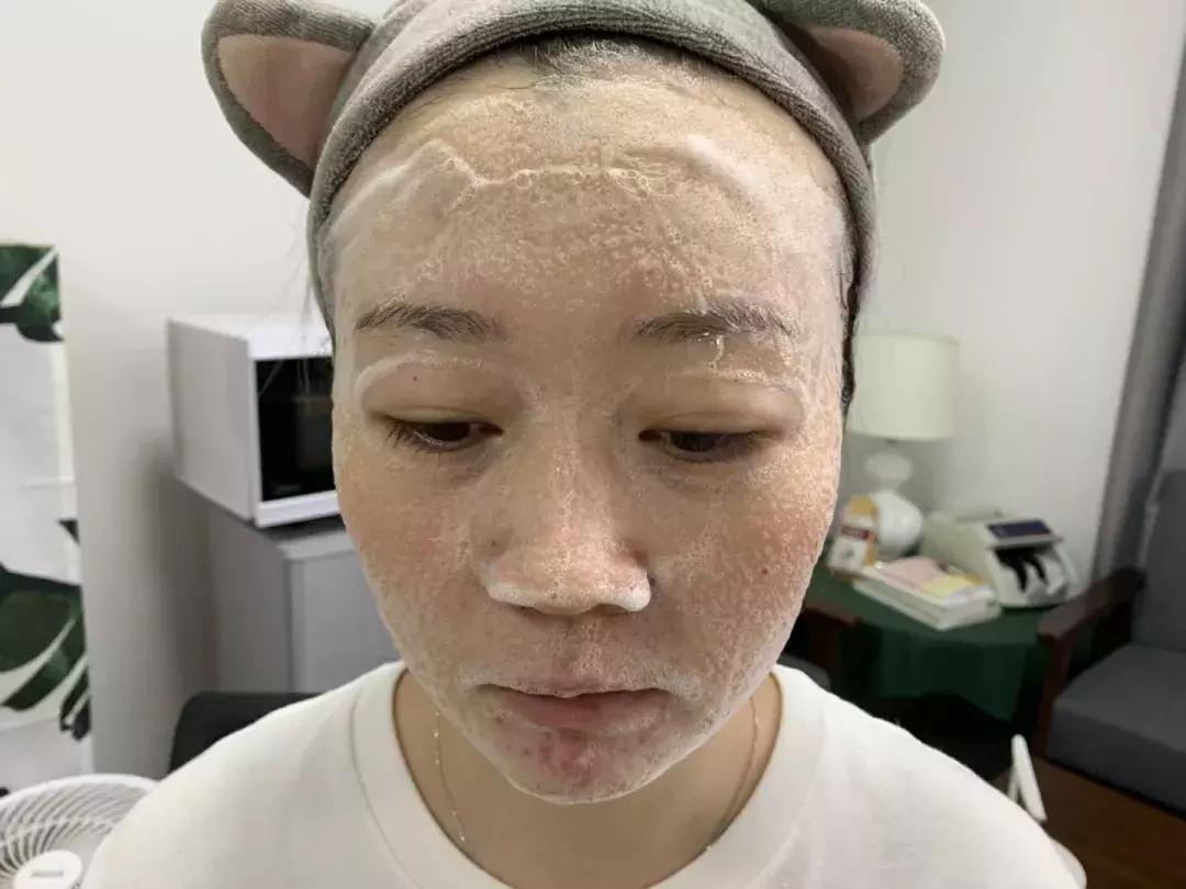 抖音很火的固体面膜真的好吗,抖音泡泡面膜真的有效果吗