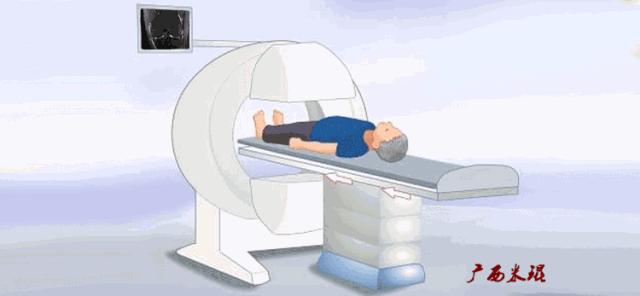 有关半月板的疾病与治疗,听骨科医生讲的话