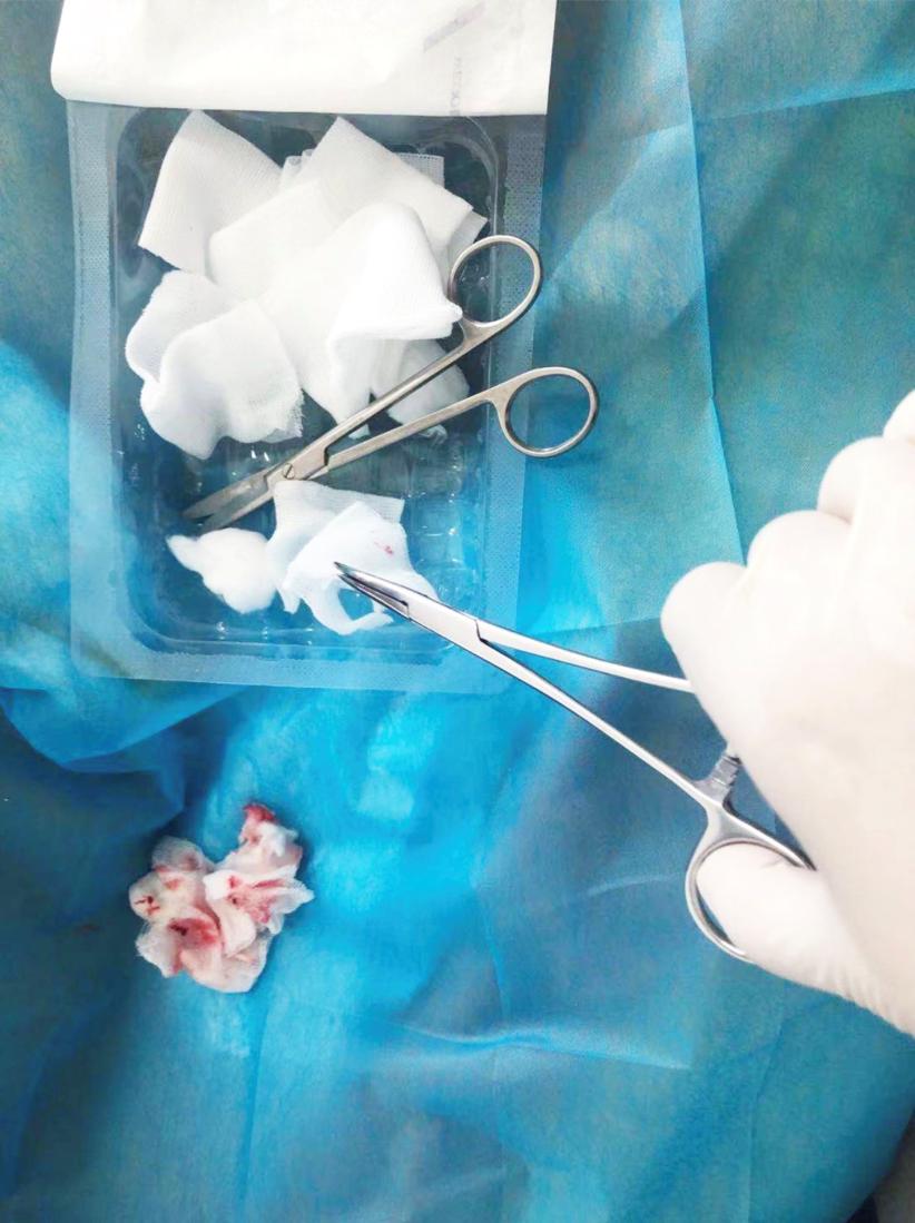 压疮病人三级护理查房,压疮护理护士给予怎样的护理