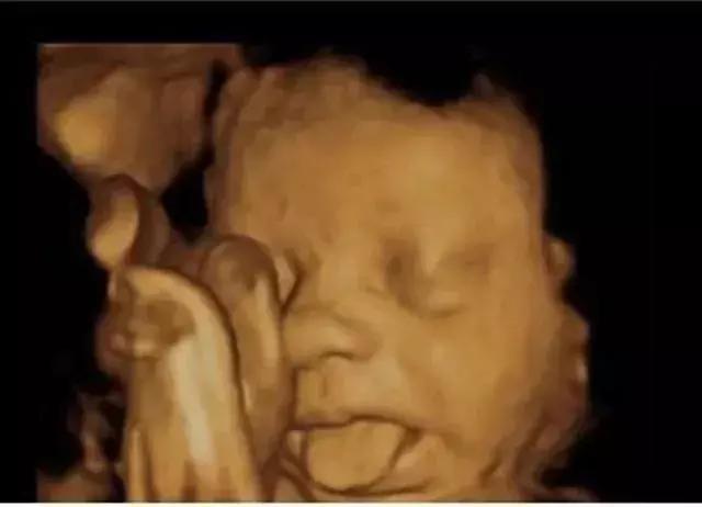 胎儿在妈妈肚子里干什么图片,胎儿在妈妈肚子里的位置变化