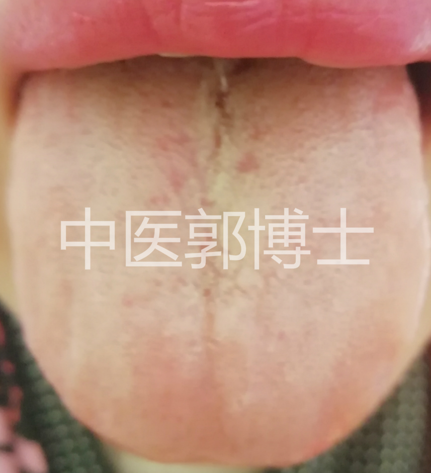 大便不成形吃药后便秘怎么回事,大便不成形胃疼拉肚子是什么原因