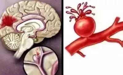 倒春寒很伤人尤其是这6个部位,倒春寒冻手冻脚