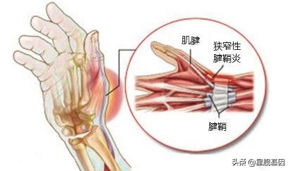 产后妈妈十大疼痛,哪一个你中招了?