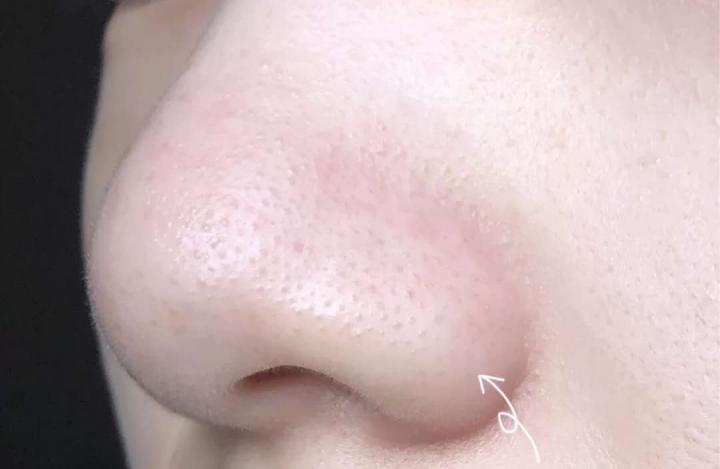 卸妆油对付黑头,家里卸妆产品用完了能用什么卸妆